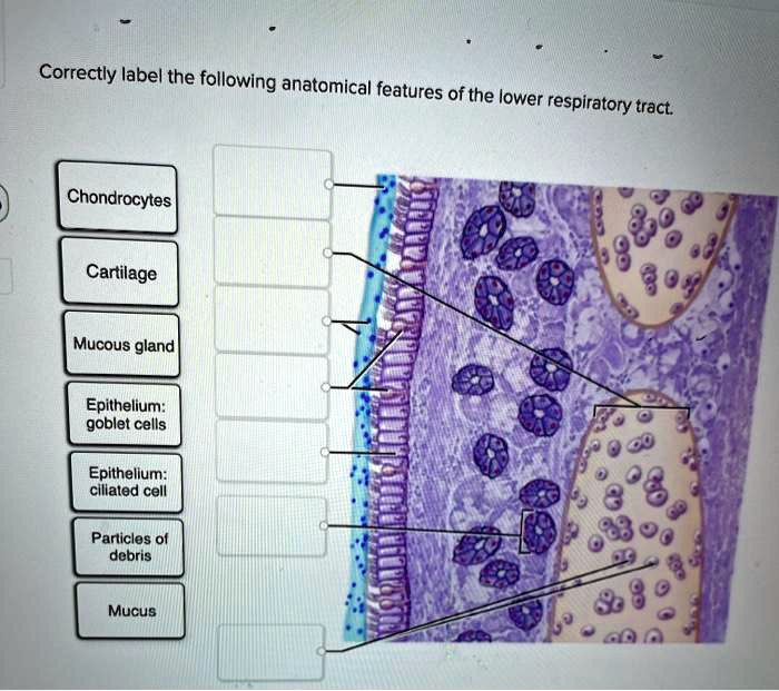 Mucous membranes connective epithelial presentation epithelium